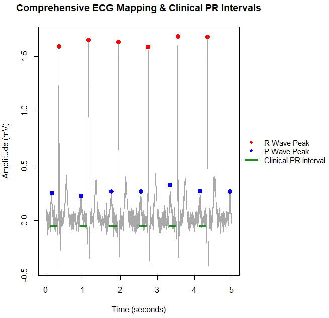Peak detection P wave (Blue), R wave (red), and PR interval (green line).